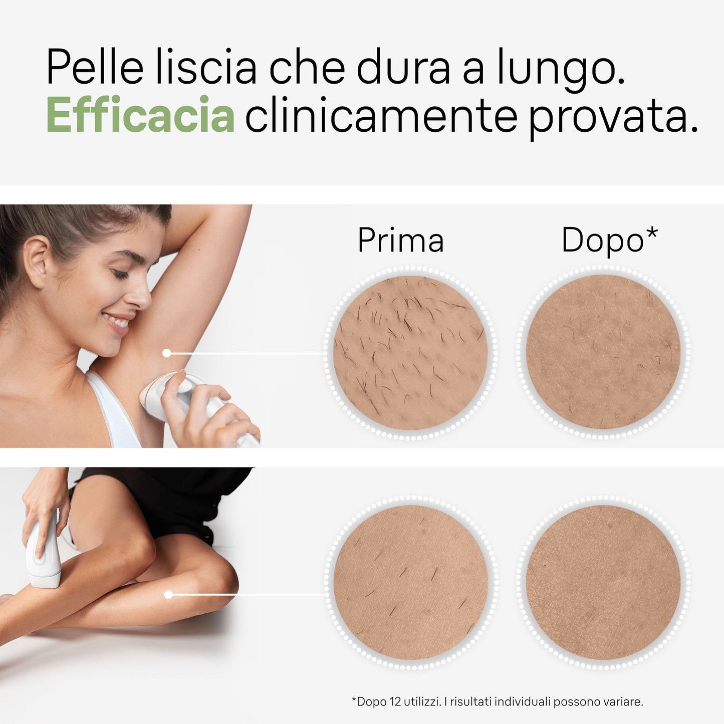 BRAUN PED PL3020 | CURA PERSONA | EPILATORI | EPILATORI LUCE PULSATA | EPILATORE LUCE PULSATA 300000
