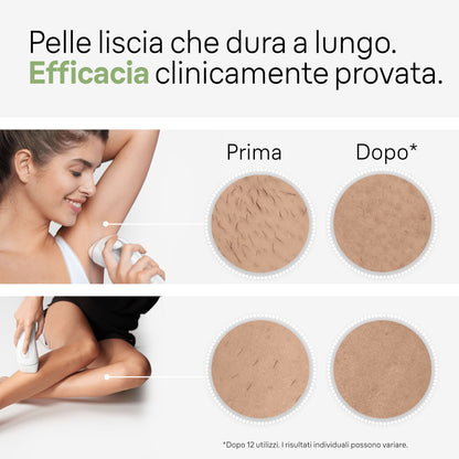 BRAUN PED PL3020 | CURA PERSONA | EPILATORI | EPILATORI LUCE PULSATA | EPILATORE LUCE PULSATA 300000